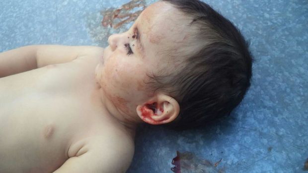 Azərbaycanın diaspor təşkilatları Zəhra ilə bağlı birgə bəyanat yaydılar