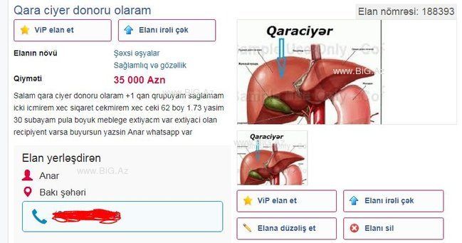 Azərbaycanda BU DA OLDU Daxili orqanlarını internetdə satışa çıxardı - ŞOK MƏBLƏĞ