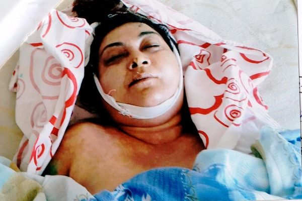 Xəstəxanada ölən qadınla bağlı Nazirlikdən əhaliyə MÜRACİƏT