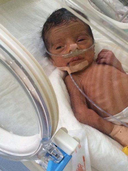 Azərbaycanda ŞOK HADİSƏ Həkim yeni doğulmuş iki körpəni oğurladı