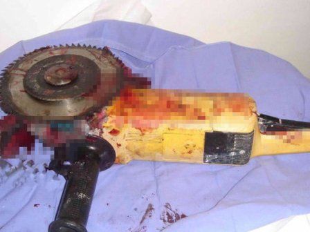 Ayağını “laqunda” kəsdi