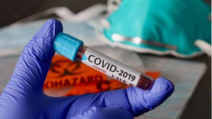 Azərbaycanda daha bir nəfər koronavirusdan öldü - 49 yeni yoluxma - VİDEO